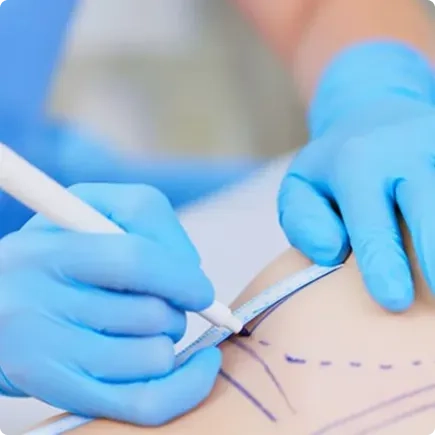 ¿Cómo es el proceso de la <em>cirugía de nariz</em>?