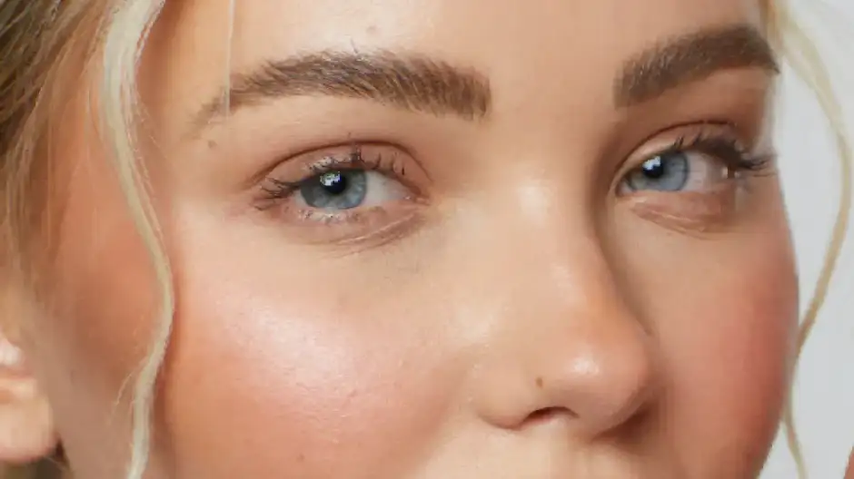 Lifting temporal o lateral