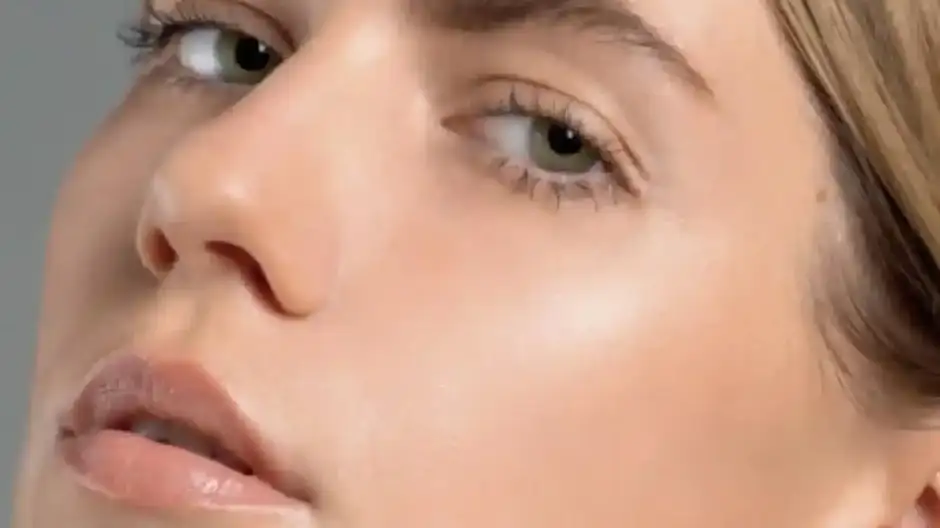 ¿Qué es el <em>tratamiento sin cirugía para aumento de pómulos</em>?