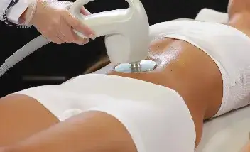 radiofrecuencia quitar estrias