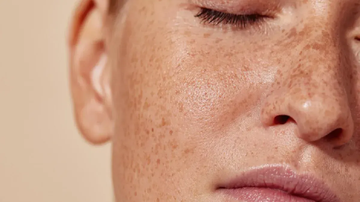 Quitar manchas en la piel