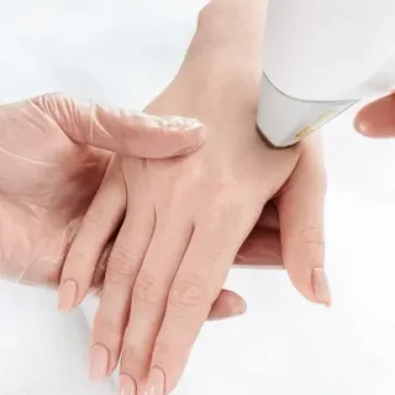 rejuvenecimiento de manos