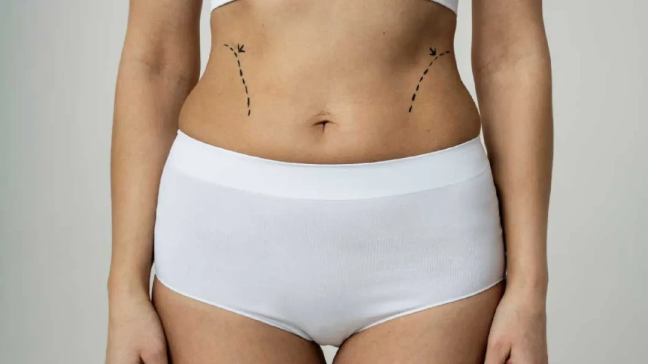 eliminar grasa caderas muslos