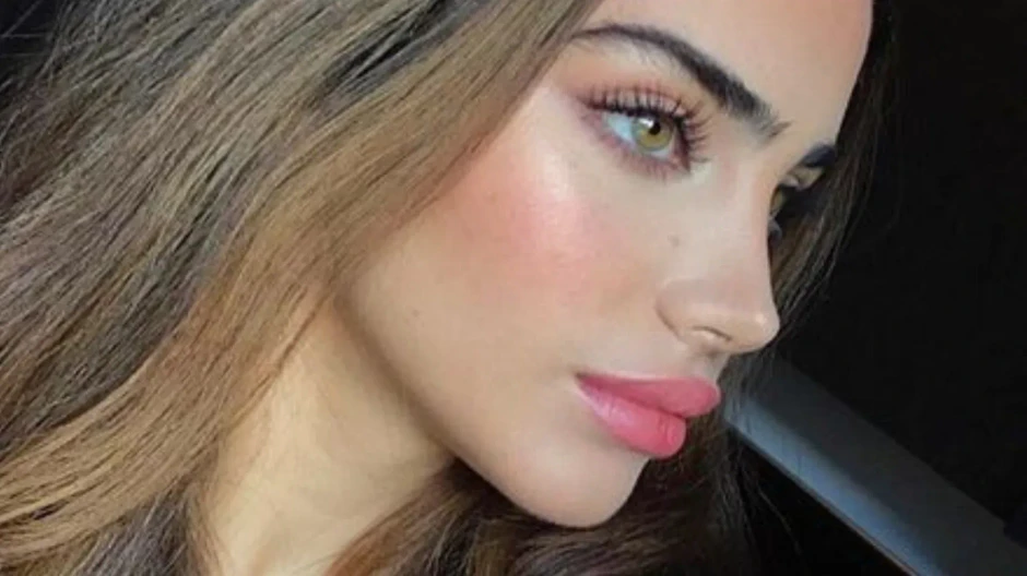 rinoplastia convencional