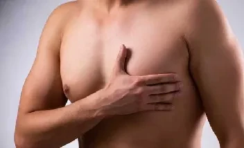 Ginecomastia mixta (combinada)