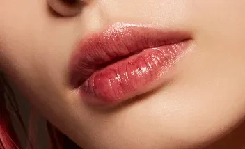 aumento y definición de labios