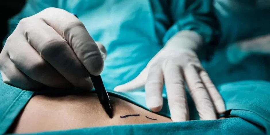  Por qué no deberías operar en una clínica de cirugía estética «low cost»